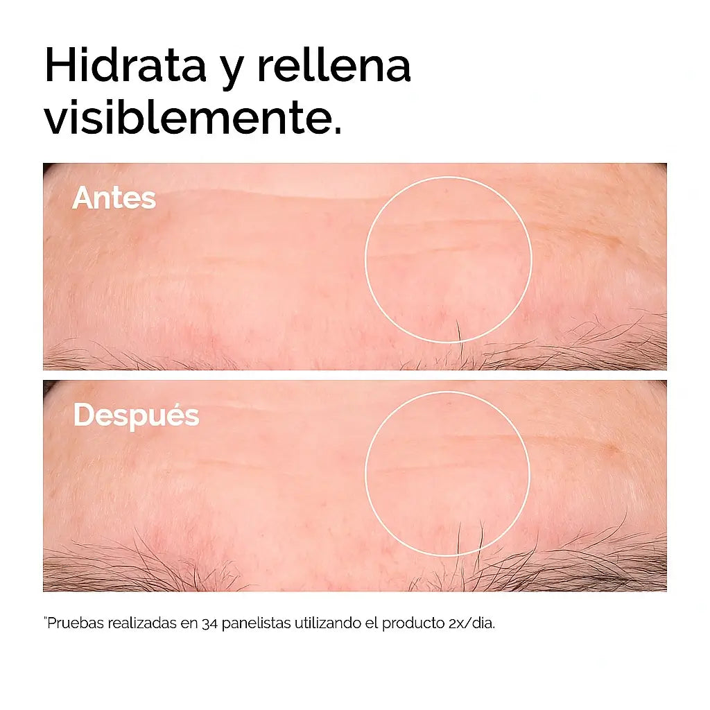 🏆Oferta Flash⚡Retinol y Acido Hialuronico - Tu piel renovada e hidratada