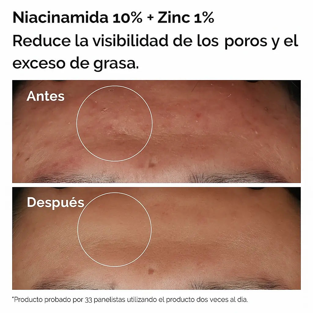 NIACINAMIDA + ACIDO HYALURONICO ✨ El dúo perfecto para una piel radiante en 7 días ✨