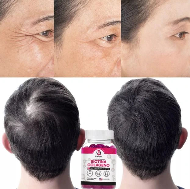 Kit Glow Up 360° GOMITAS BIOTINA+COLAGENO y DE VINAGRE DE MANZANA